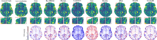 Figure 4 for Efficient Vision Mamba for MRI Super-Resolution via Hybrid Selective Scanning