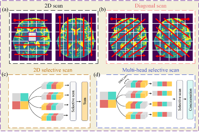 Figure 1 for Efficient Vision Mamba for MRI Super-Resolution via Hybrid Selective Scanning
