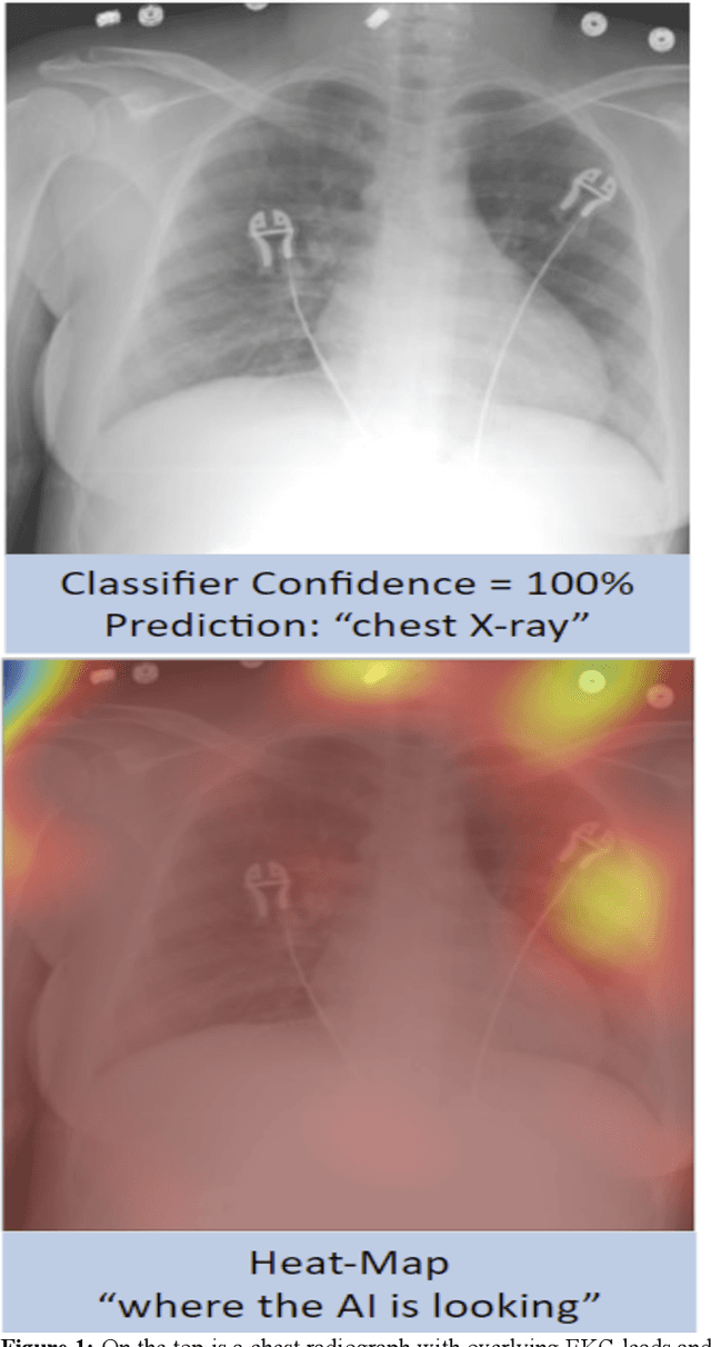 Figure 1 for Generalization of Artificial Intelligence Models in Medical Imaging: A Case-Based Review