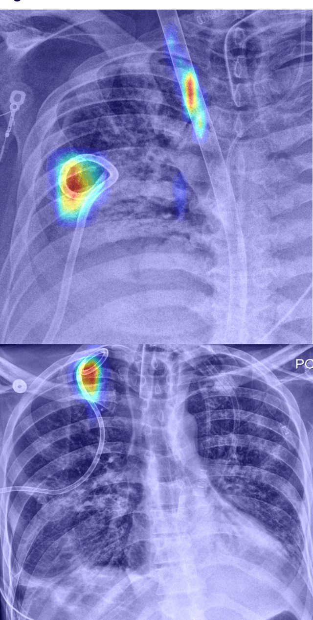 Figure 2 for Generalization of Artificial Intelligence Models in Medical Imaging: A Case-Based Review
