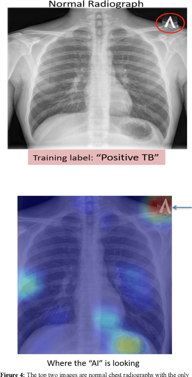 Figure 3 for Generalization of Artificial Intelligence Models in Medical Imaging: A Case-Based Review