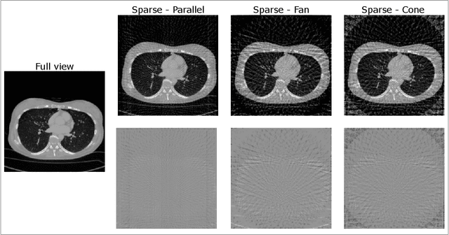 Figure 2 for Beam Geometry and Input Dimensionality: Impact on Sparse-Sampling Artifact Correction for Clinical CT with U-Nets