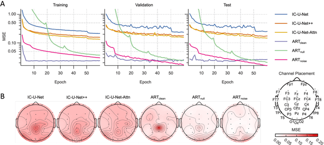 Figure 3 for ART: Artifact Removal Transformer for Reconstructing Noise-Free Multichannel Electroencephalographic Signals