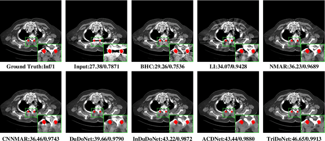 Figure 2 for TriDoNet: A Triple Domain Model-driven Network for CT Metal Artifact Reduction