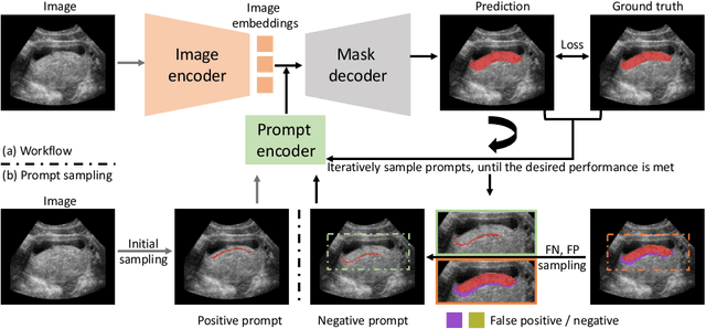 Figure 1 for Interactive Segmentation Model for Placenta Segmentation from 3D Ultrasound images