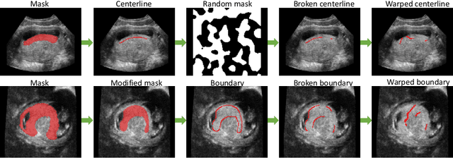 Figure 3 for Interactive Segmentation Model for Placenta Segmentation from 3D Ultrasound images