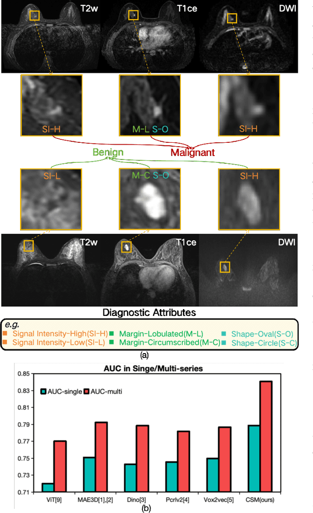 Figure 1 for Enhanced MRI Representation via Cross-series Masking