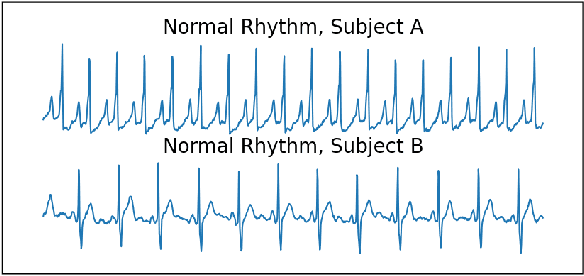 Figure 1 for Parallel-Learning of Invariant and Tempo-variant Attributes of Single-Lead Cardiac Signals: PLITA