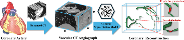 Figure 1 for ViG3D-UNet: Volumetric Vascular Connectivity-Aware Segmentation via 3D Vision Graph Representation