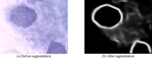 Figure 3 for Segmentation and Classification of Pap Smear Images for Cervical Cancer Detection Using Deep Learning