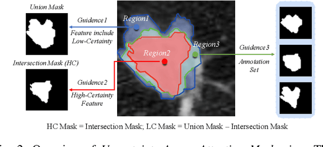 Figure 4 for Lung Nodule Segmentation and Low-Confidence Region Prediction with Uncertainty-Aware Attention Mechanism