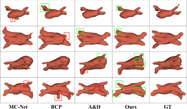Figure 2 for Boosting Generic Semi-Supervised Medical Image Segmentation via Diverse Teaching and Label Propagation