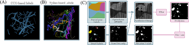 Figure 1 for A label-free and data-free training strategy for vasculature segmentation in serial sectioning OCT data