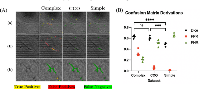 Figure 2 for A label-free and data-free training strategy for vasculature segmentation in serial sectioning OCT data