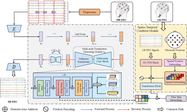 Figure 2 for Spatio-Temporal Adaptive Diffusion Models for EEG Super-Resolution in Epilepsy Diagnosis