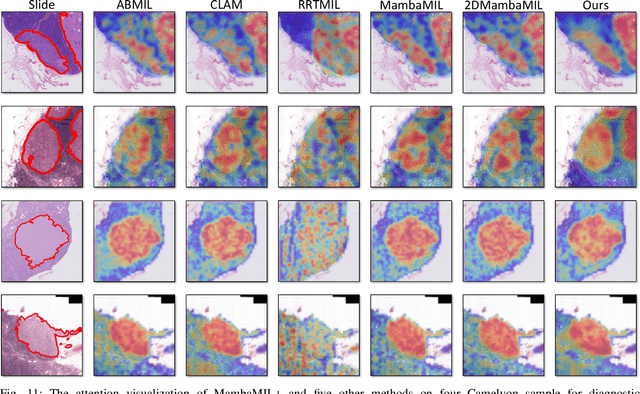 Figure 3 for MambaMIL+: Modeling Long-Term Contextual Patterns for Gigapixel Whole Slide Image