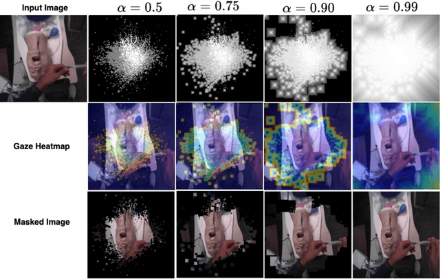 Figure 1 for Airway Skill Assessment with Spatiotemporal Attention Mechanisms Using Human Gaze