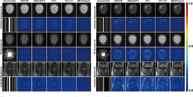 Figure 2 for Magnetic Resonance Image Processing Transformer for General Reconstruction