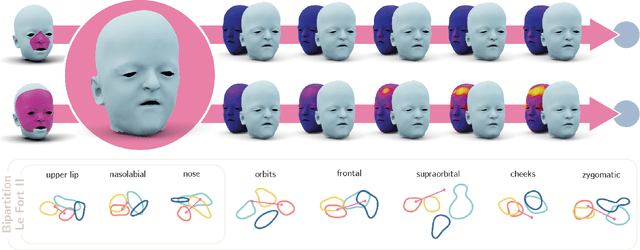 Figure 4 for Latent Disentanglement in Mesh Variational Autoencoders Improves the Diagnosis of Craniofacial Syndromes and Aids Surgical Planning