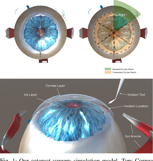Figure 1 for Toward a Surgeon-in-the-Loop Ophthalmic Robotic Apprentice using Reinforcement and Imitation Learning