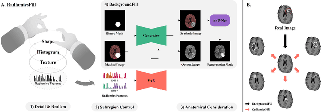 Figure 1 for Synthetic Tumor Manipulation: With Radiomics Features