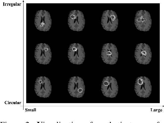 Figure 3 for Synthetic Tumor Manipulation: With Radiomics Features
