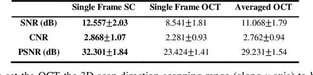 Figure 2 for Resolution Improvement for OpticalCoherence Tomography based on Sparse Continuous Deconvolution