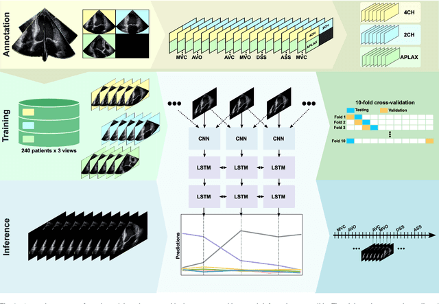 Figure 1 for Cardiac valve event timing in echocardiography using deep learning and triplane recordings