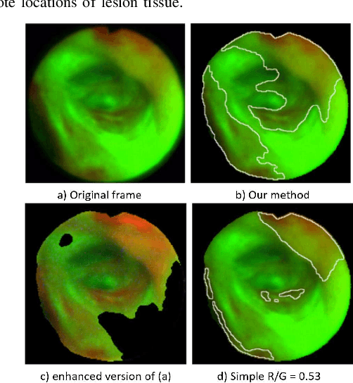 Figure 4 for Autofluorescence Bronchoscopy Video Analysis for Lesion Frame Detection