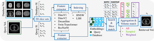 Figure 1 for Medical Image Retrieval Using Pretrained Embeddings