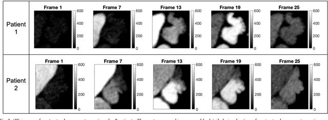 Figure 3 for Estimation of Blood Flow Parameters in the Left Atrial Appendage from 4DCT Dynamic Contrast Enhancement
