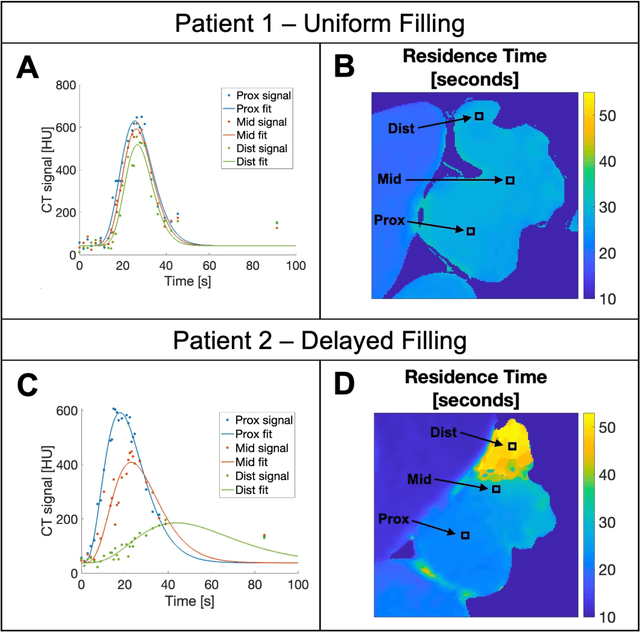 Figure 4 for Estimation of Blood Flow Parameters in the Left Atrial Appendage from 4DCT Dynamic Contrast Enhancement