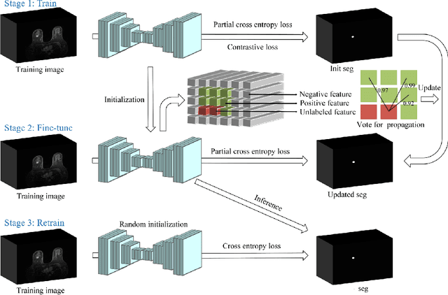 Figure 3 for SimPLe: Similarity-Aware Propagation Learning for Weakly-Supervised Breast Cancer Segmentation in DCE-MRI