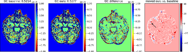 Figure 4 for Fine-Tuning TransMorph with Gradient Correlation for Anatomical Alignment