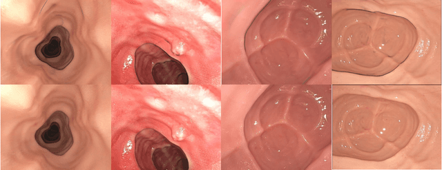 Figure 1 for EndoPBR: Material and Lighting Estimation for Photorealistic Surgical Simulations via Physically-based Rendering