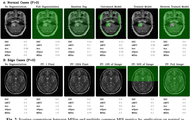 Figure 2 for MISm: A Medical Image Segmentation Metric for Evaluation of weak labeled Data