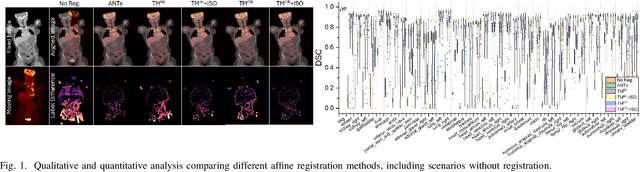 Figure 1 for Unsupervised Learning of Multi-modal Affine Registration for PET/CT