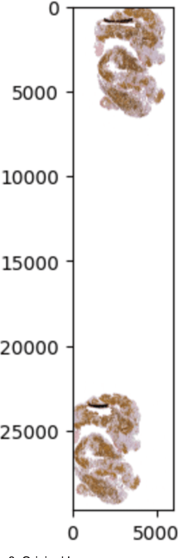 Figure 3 for Image Classification of Stroke Blood Clot Origin using Deep Convolutional Neural Networks and Visual Transformers