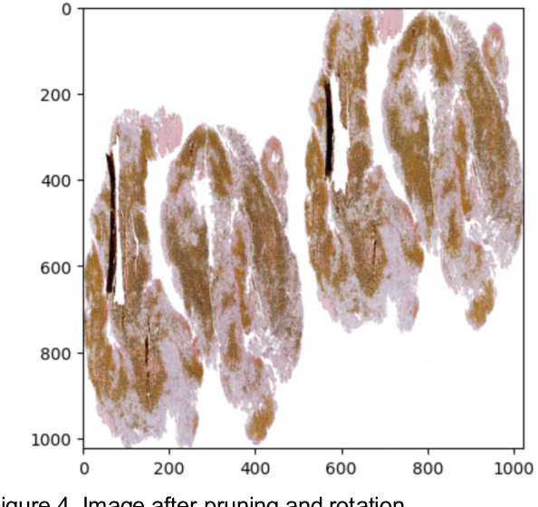 Figure 4 for Image Classification of Stroke Blood Clot Origin using Deep Convolutional Neural Networks and Visual Transformers
