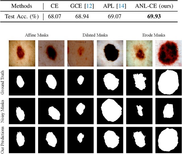 Figure 4 for Active Negative Loss: A Robust Framework for Learning with Noisy Labels