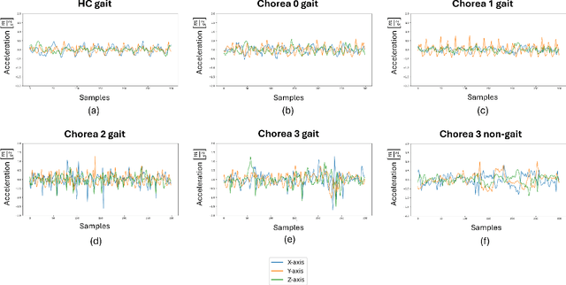 Figure 3 for Detecting Daily Living Gait Amid Huntington's Disease Chorea using a Foundation Deep Learning Model