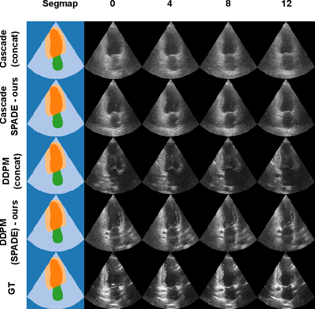 Figure 4 for Echocardiography video synthesis from end diastolic semantic map via diffusion model