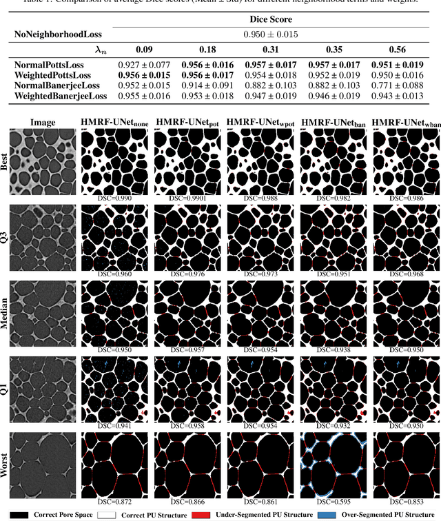Figure 2 for Unsupervised Segmentation of Micro-CT Scans of Polyurethane Structures By Combining Hidden-Markov-Random Fields and a U-Net