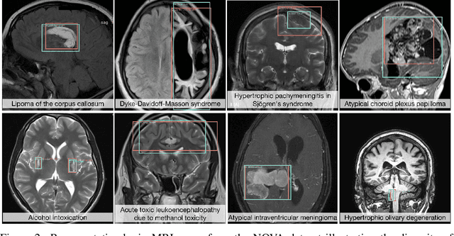 Figure 3 for NOVA: A Benchmark for Anomaly Localization and Clinical Reasoning in Brain MRI