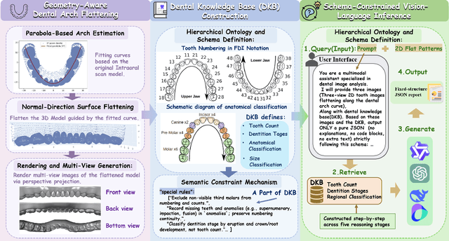 Figure 1 for ArchMap: Arch-Flattening and Knowledge-Guided Vision Language Model for Tooth Counting and Structured Dental Understanding
