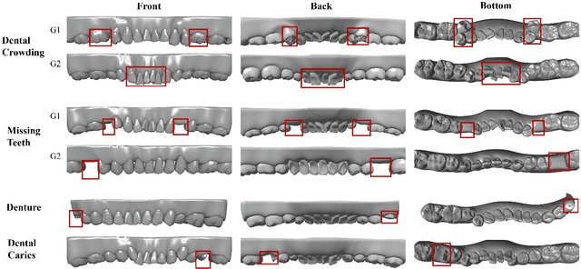 Figure 2 for ArchMap: Arch-Flattening and Knowledge-Guided Vision Language Model for Tooth Counting and Structured Dental Understanding