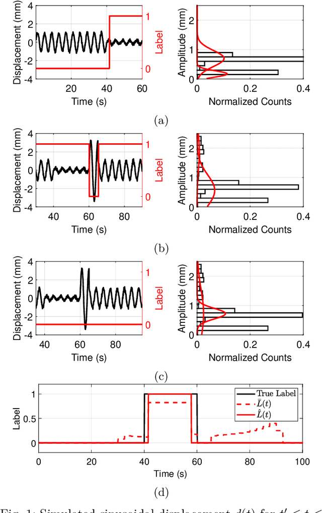 Figure 1 for Accurate Radar-Based Detection of Sleep Apnea Using Overlapping Time-Interval Averaging