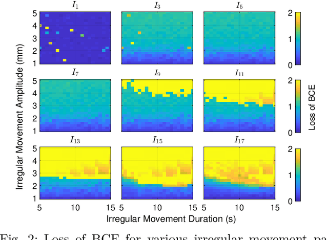 Figure 2 for Accurate Radar-Based Detection of Sleep Apnea Using Overlapping Time-Interval Averaging