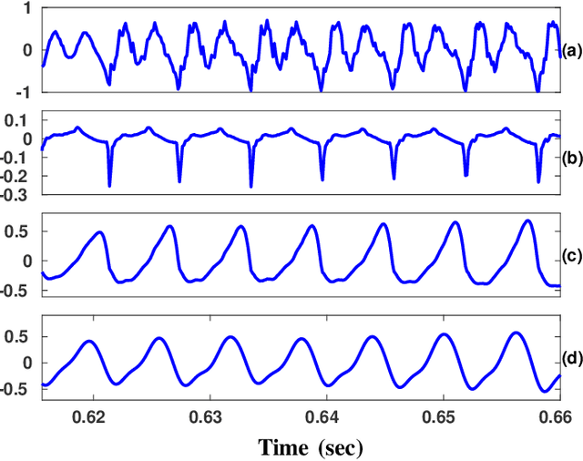 Figure 3 for Analysis and Detection of Pathological Voice using Glottal Source Features