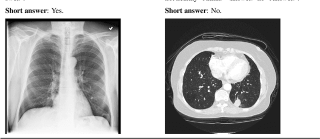 Figure 1 for RARL: Improving Medical VLM Reasoning and Generalization with Reinforcement Learning and LoRA under Data and Hardware Constraints